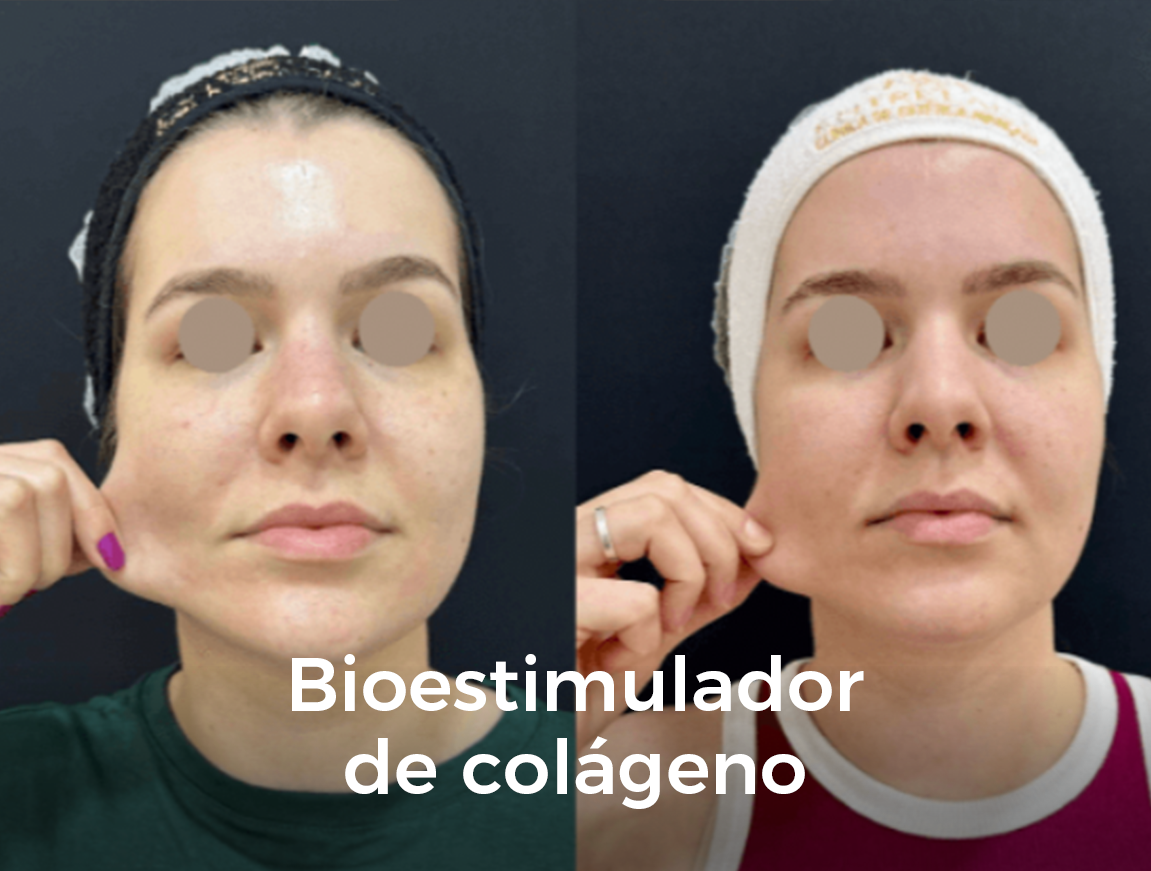 bioesimulador