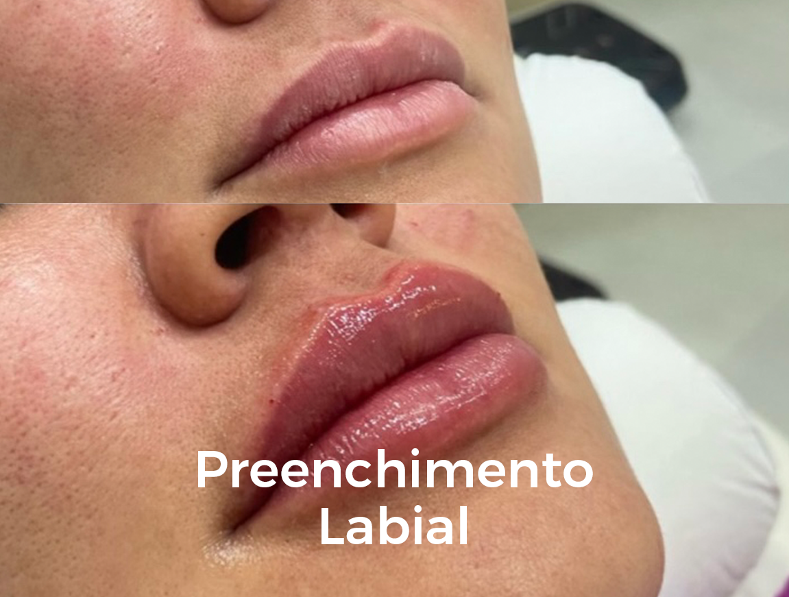 preenchimento 2