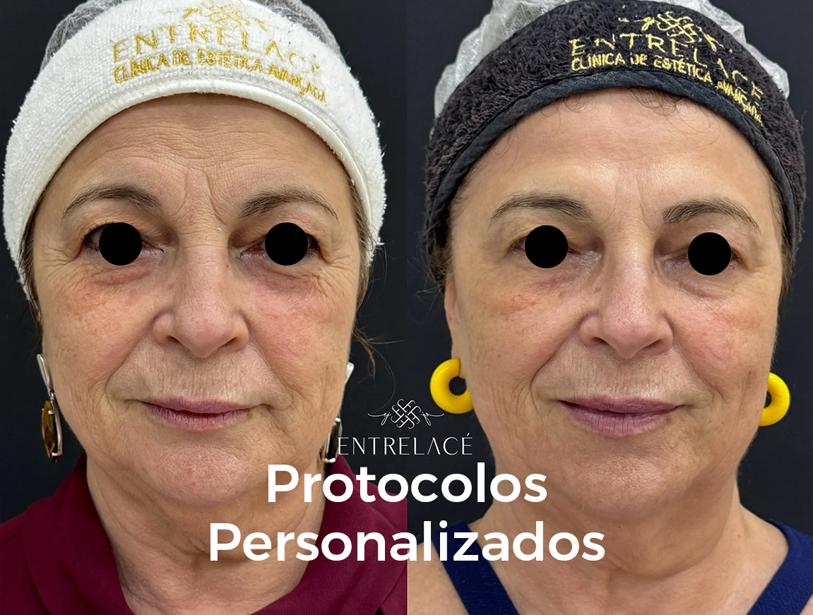 protocolo